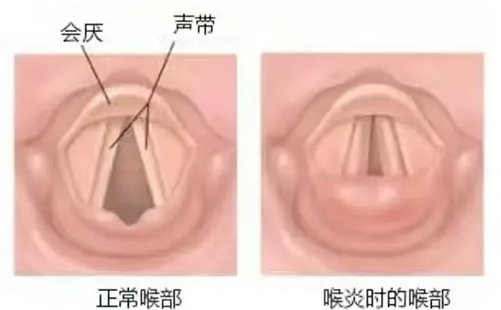 图片 2.png