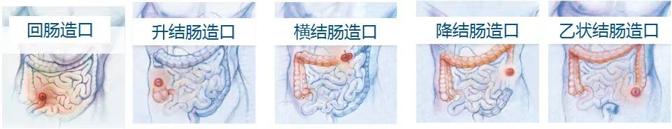 图片 1.png